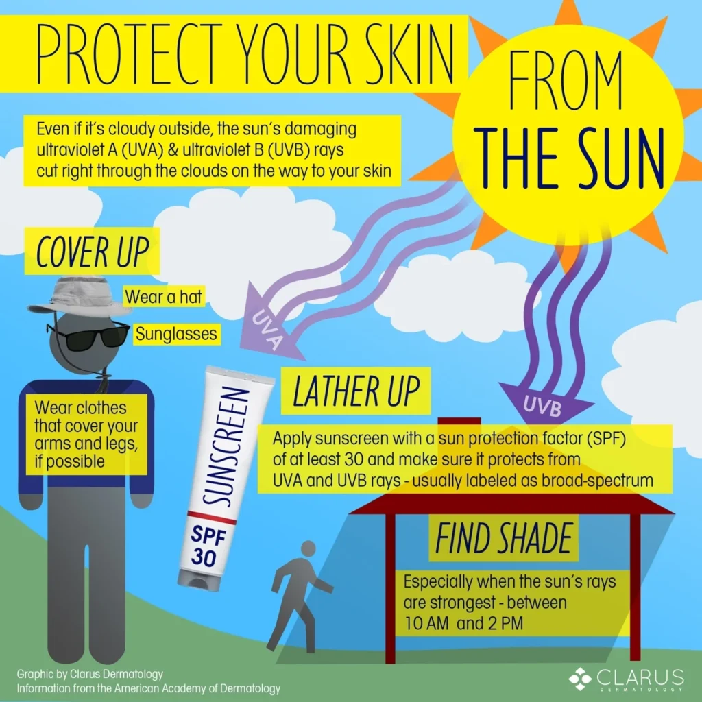 Sun protection guide for newborn and infant skin care