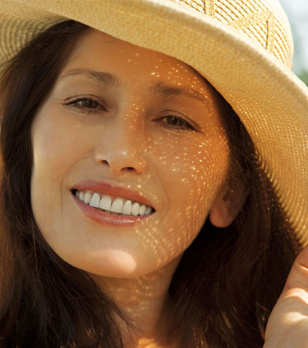 Laser treatment for acne scars