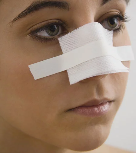 Mohs facial surgery