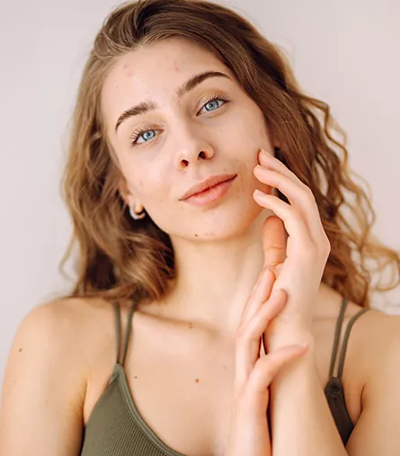 acne treatment