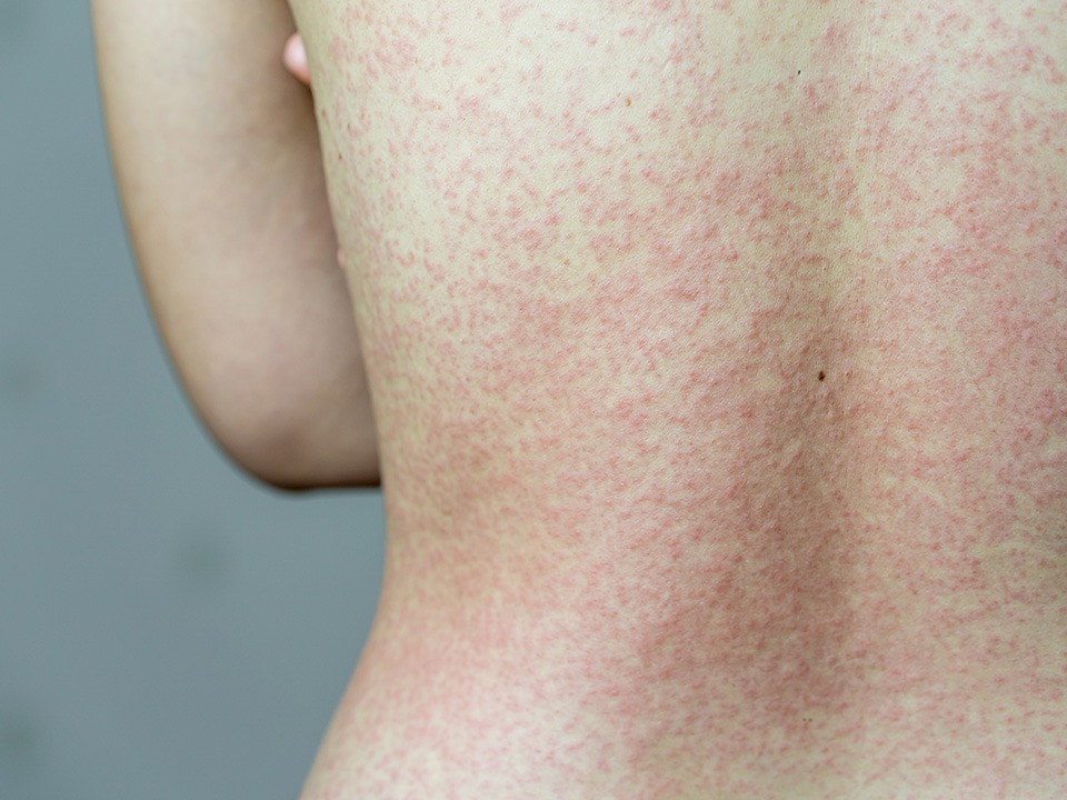 Medical Dermatology Specialists | Clarus Dermatology